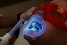کاربرد فناوری نانو در دندان پزشکی 